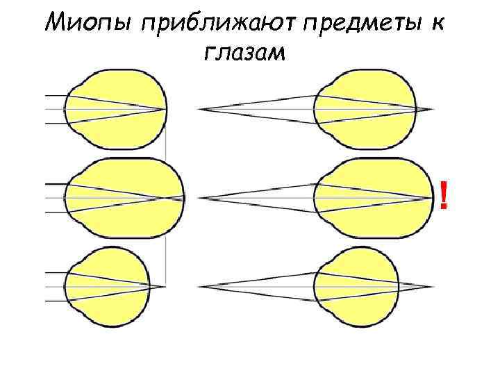 Миопы приближают предметы к глазам 