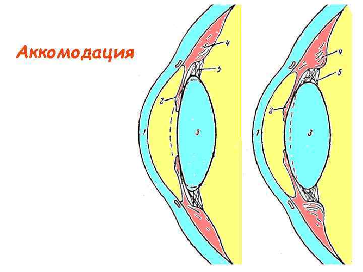 Аккомодация 