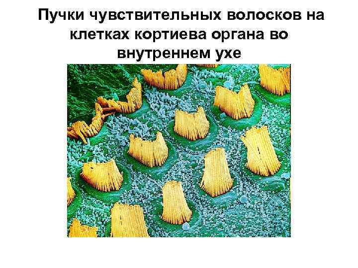  Пучки чувствительных волосков на клетках кортиева органа во внутреннем ухе 