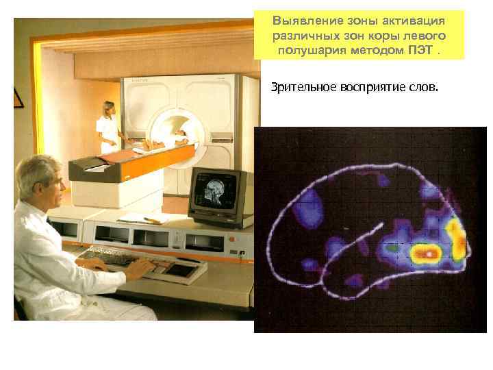 Выявление зоны активация различных зон коры левого полушария методом ПЭТ. Зрительное восприятие слов. 