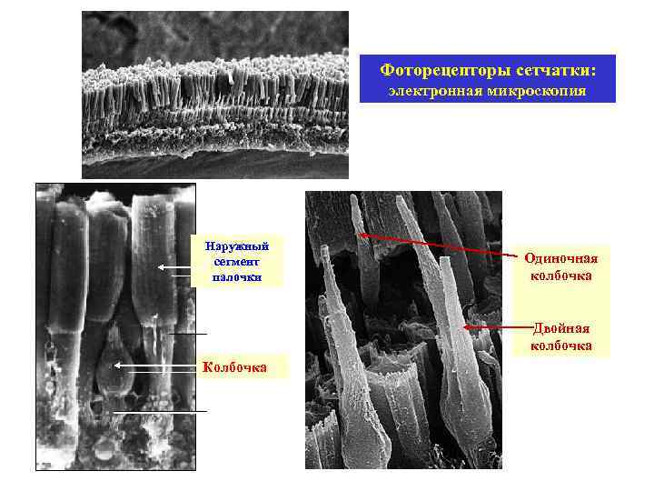 Фоторецепторы сетчатки: электронная микроскопия Наружный сегмент палочки Одиночная колбочка Двойная колбочка Колбочка 