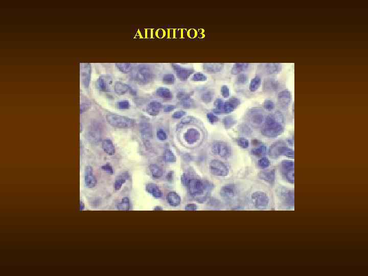 АПОПТОЗ 