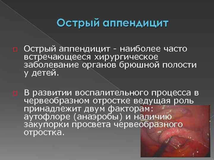 Острый аппендицит o o Острый аппендицит - наиболее часто встречающееся хирургическое заболевание органов брюшной