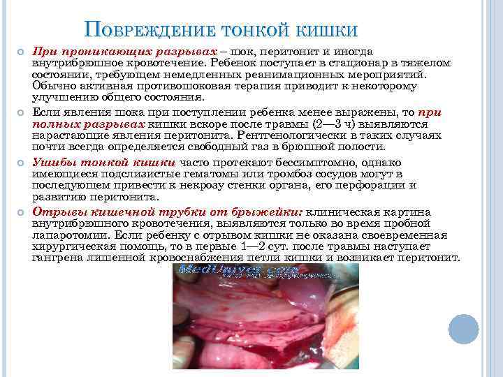 ПОВРЕЖДЕНИЕ ТОНКОЙ КИШКИ При проникающих разрывах – шок, перитонит и иногда внутрибрюшное кровотечение. Ребенок