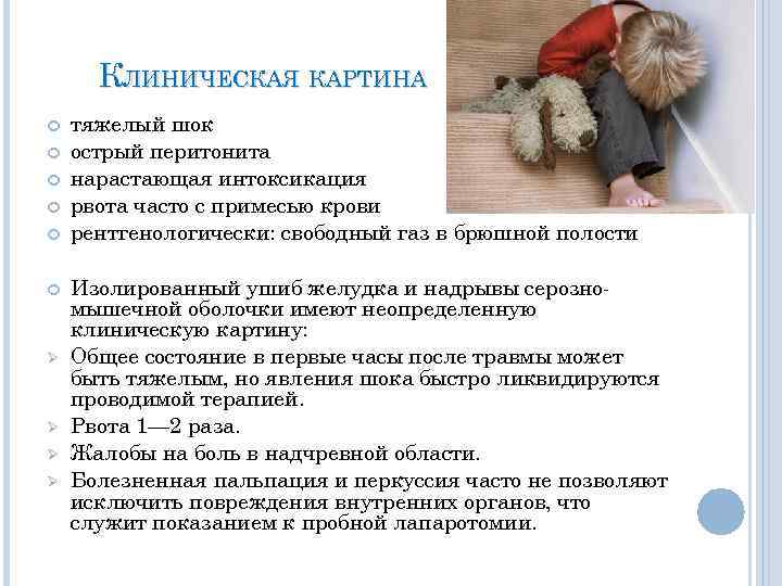 КЛИНИЧЕСКАЯ КАРТИНА Ø Ø тяжелый шок острый перитонита нарастающая интоксикация рвота часто с примесью