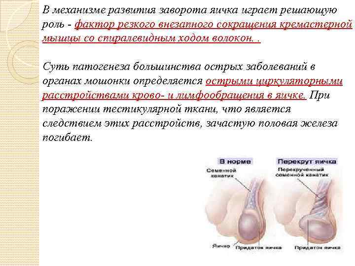 В механизме развития заворота яичка играет решающую роль - фактор резкого внезапного сокращения кремастерной