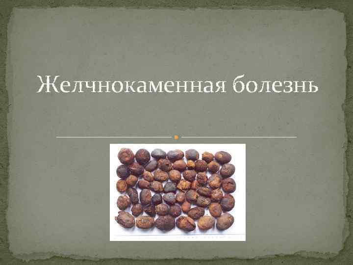 Желчнокаменная болезнь презентация