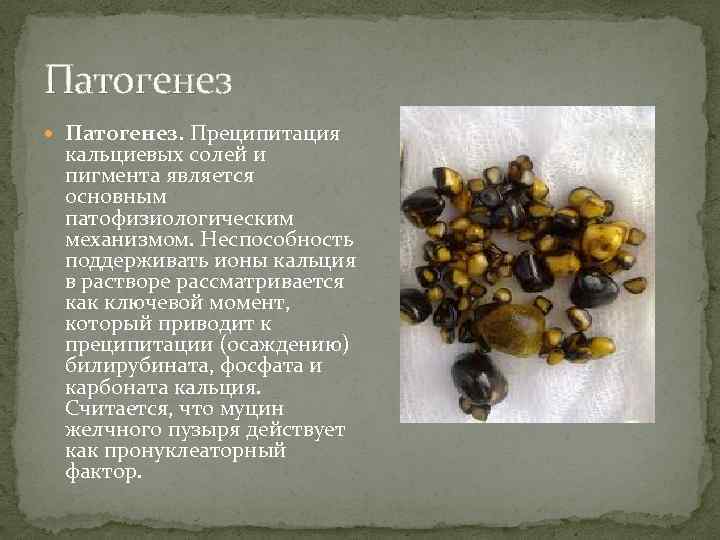 Патогенез Патогенез. Преципитация кальциевых солей и пигмента является основным патофизиологическим механизмом. Неспособность поддерживать ионы