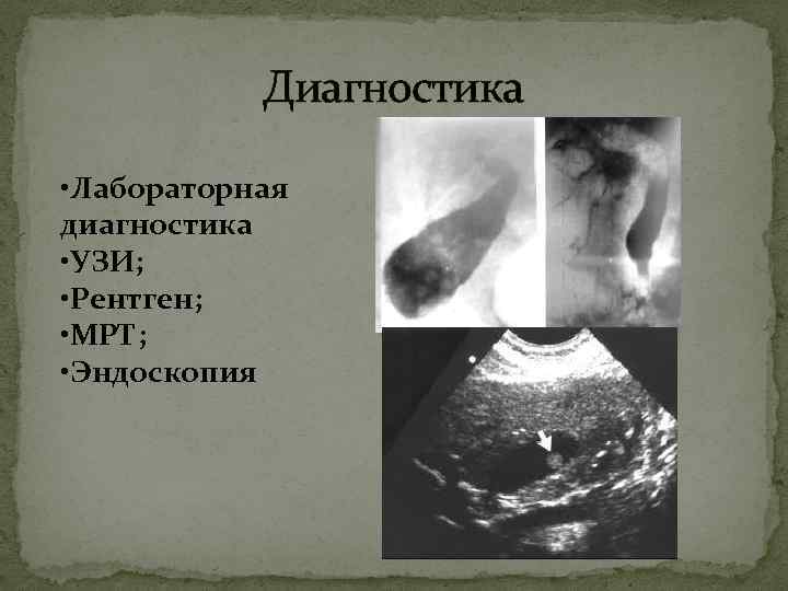 Диагностика • Лабораторная диагностика • УЗИ; • Рентген; • МРТ; • Эндоскопия 