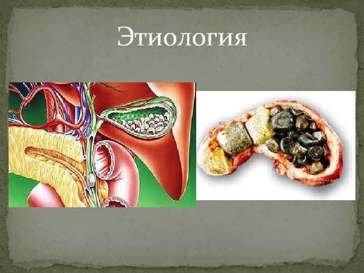 Этиология 