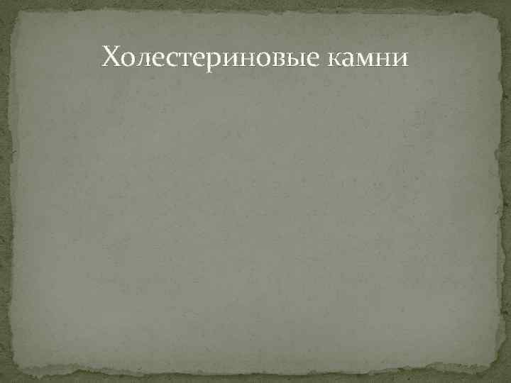 Холестериновые камни 