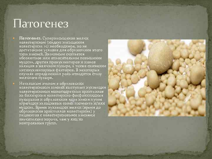Патогенез Патогенез. Супернасыщение желчи холестерином (индекс насыщения холестерина >1) необходимое, но не достаточное условие