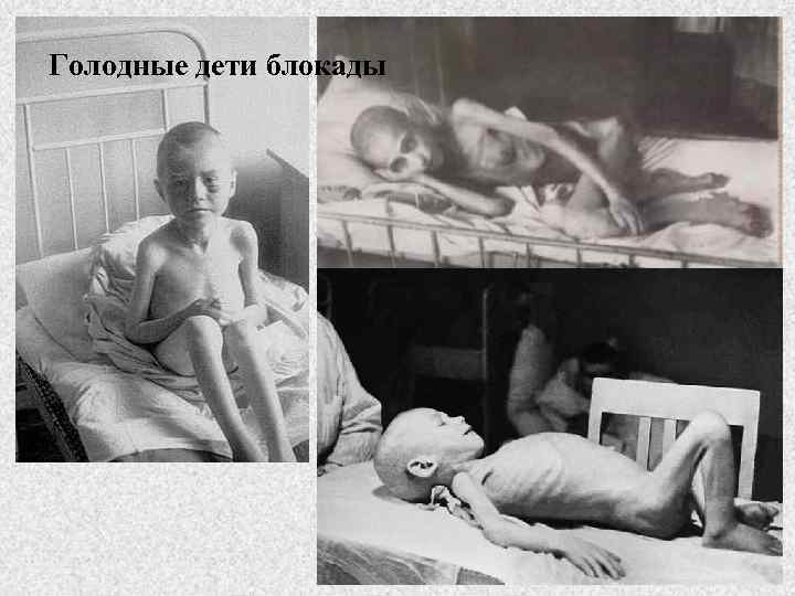 Голодные дети блокады 