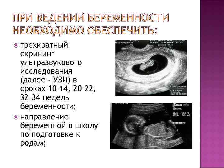  трехкратный скрининг ультразвукового исследования (далее - УЗИ) в сроках 10 -14, 20 -22,