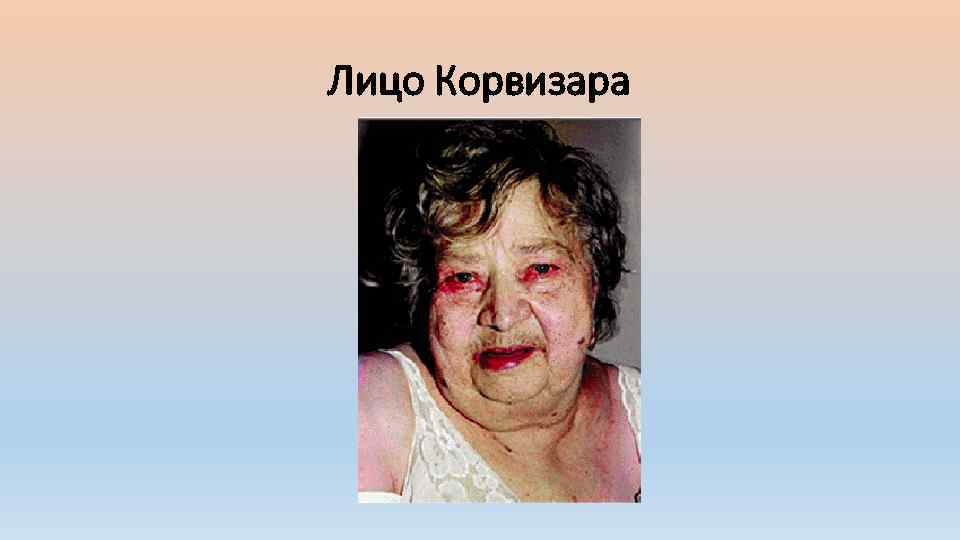 Лицо Корвизара 