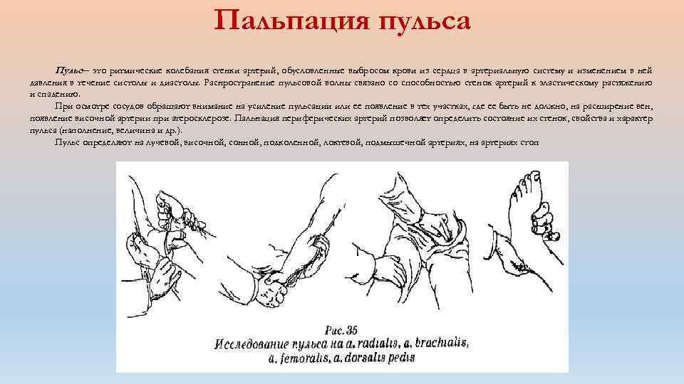 Пальпация пульса Пульс— это ритмические колебания стенки арте ий, обусловленные выбросом крови из сердца