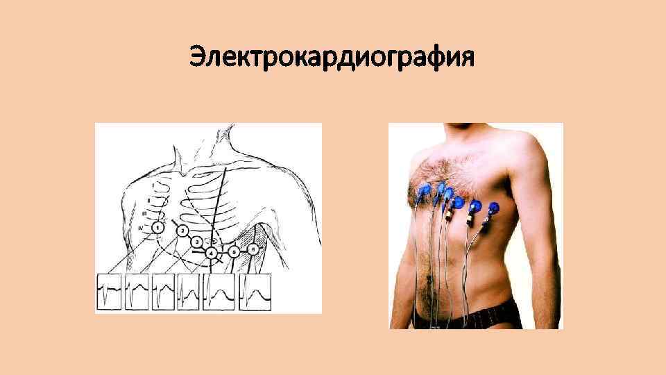Электрокардиография 