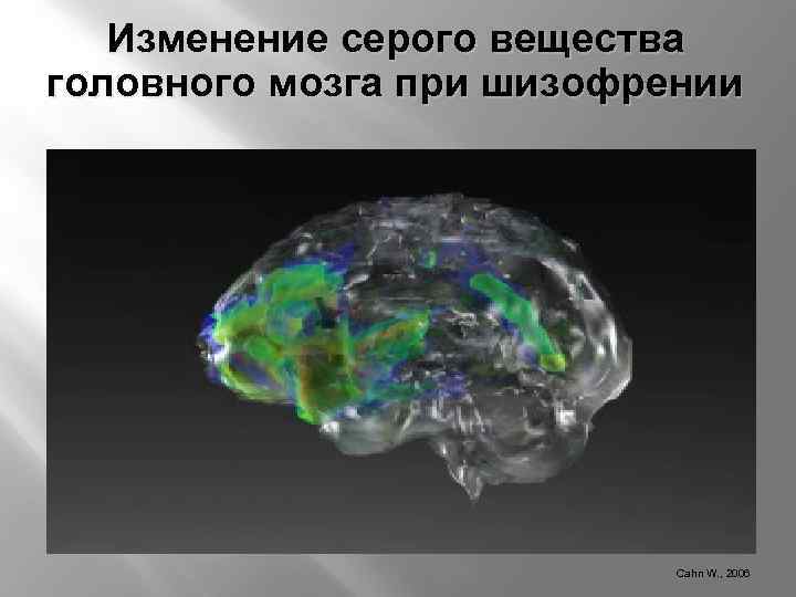 Изменение серого вещества головного мозга при шизофрении Cahn W. , 2006 