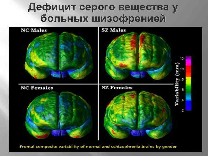 Диагностика шизофрении по картинкам