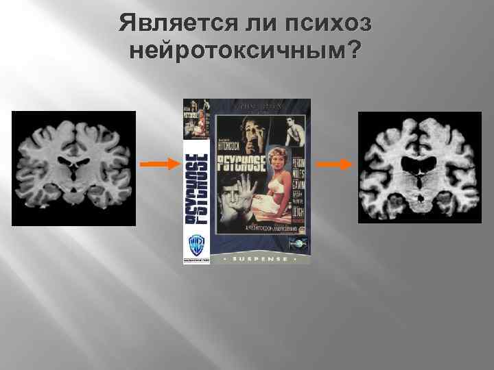 Является ли психоз нейротоксичным? 