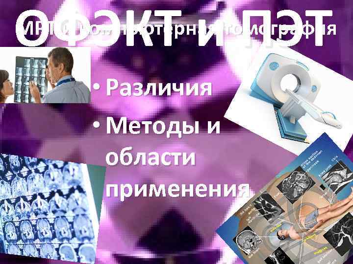 ОФЭКТ и ПЭТ МРТ и компьютерная томография • Различия • Методы и области применения