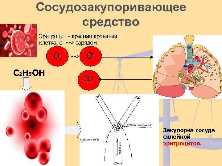 Сосудозакупоривающее средство Эритроцит - красная кровяная клетка, с «-» зарядом О 2 С 2