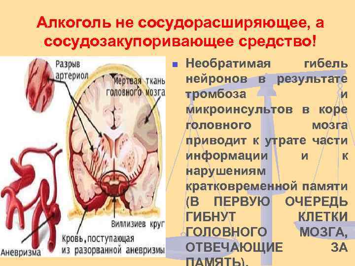 Алкоголь не сосудорасширяющее, а сосудозакупоривающее средство! n Необратимая гибель нейронов в результате тромбоза и