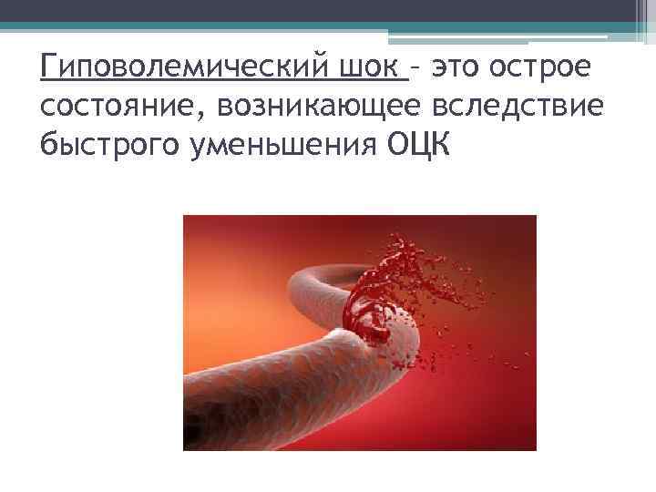 Гиповолемический шок – это острое состояние, возникающее вследствие быстрого уменьшения ОЦК 