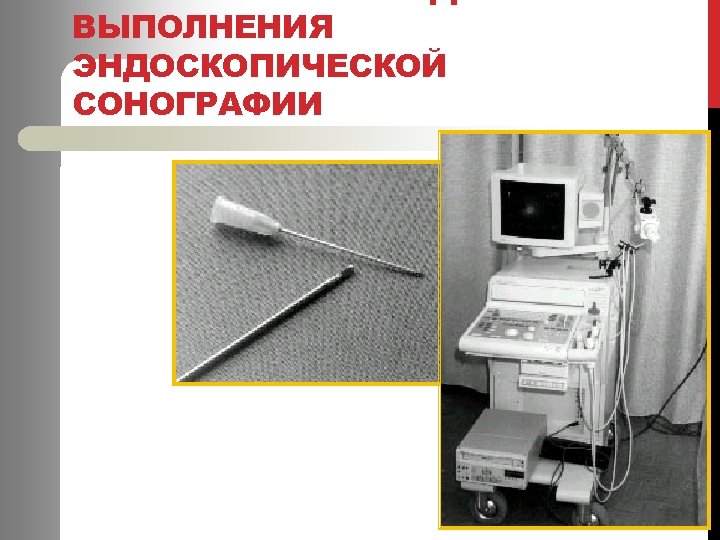 ПРИСПОСОБЛЕНИЕ ДЛЯ ВЫПОЛНЕНИЯ ЭНДОСКОПИЧЕСКОЙ СОНОГРАФИИ 