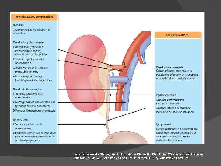 Transplantation at a Glance, First Edition. Menna Clatworthy, Christopher Watson, Michael Allison and John