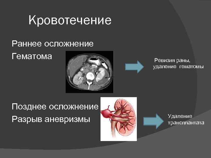 Кровотечение Раннее осложнение Гематома Позднее осложнение Разрыв аневризмы Ревизия раны, удаление гематомы Удаление трансплантата