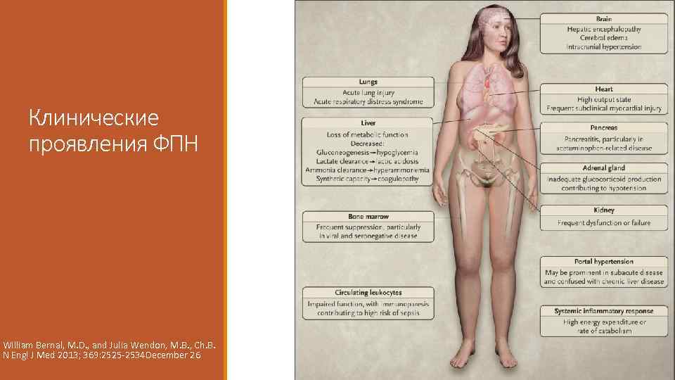 Клинические проявления ФПН William Bernal, M. D. , and Julia Wendon, M. B. ,