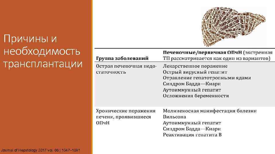 Причины и необходимость трансплантации Journal of Hepatology 2017 vol. 66 | 1047– 1081 