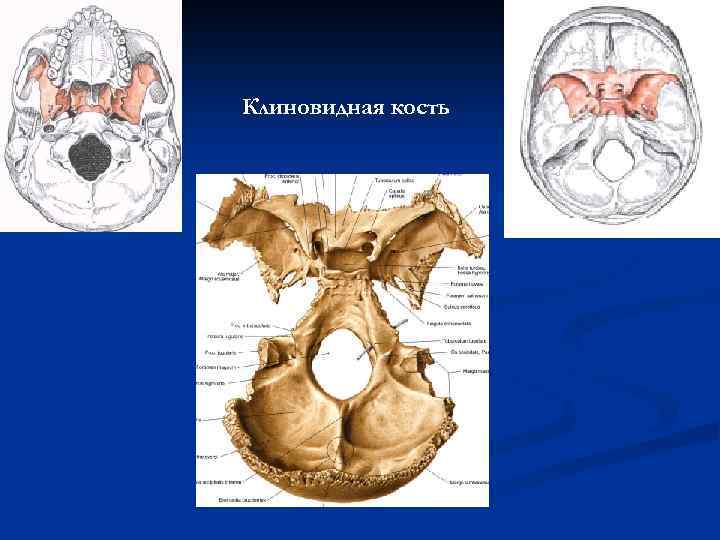 Клиновидная кость 