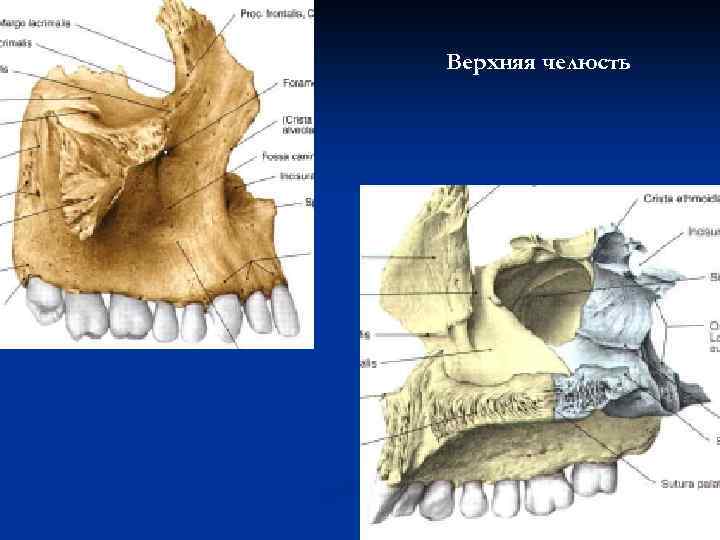 Верхняя челюсть 