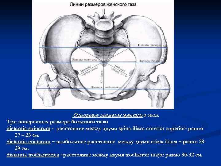 Основные размеры женского таза. Три поперечных размера большого таза: distantia spinarum - расстояние между