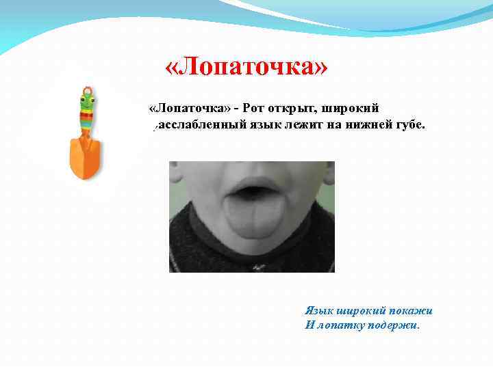  «Лопаточка» - Рот открыт, широкий расслабленный язык лежит на нижней губе. Язык широкий
