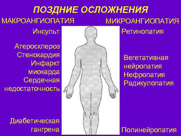 ПОЗДНИЕ ОСЛОЖНЕНИЯ МАКРОАНГИОПАТИЯ Инсульт Атеросклероз Стенокардия Инфаркт миокарда Сердечная недостаточность Диабетическая гангрена МИКРОАНГИОПАТИЯ Ретинопатия