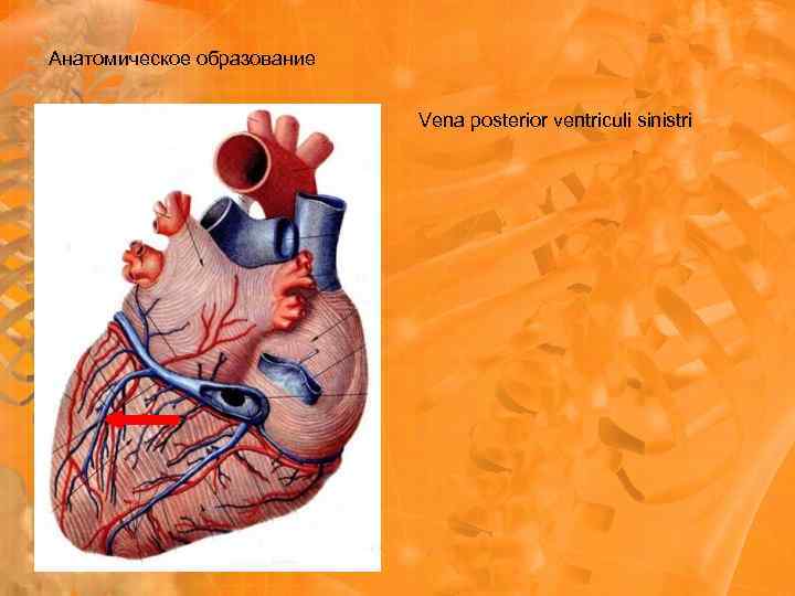 Анатомическое образование Vena posterior ventriculi sinistri 