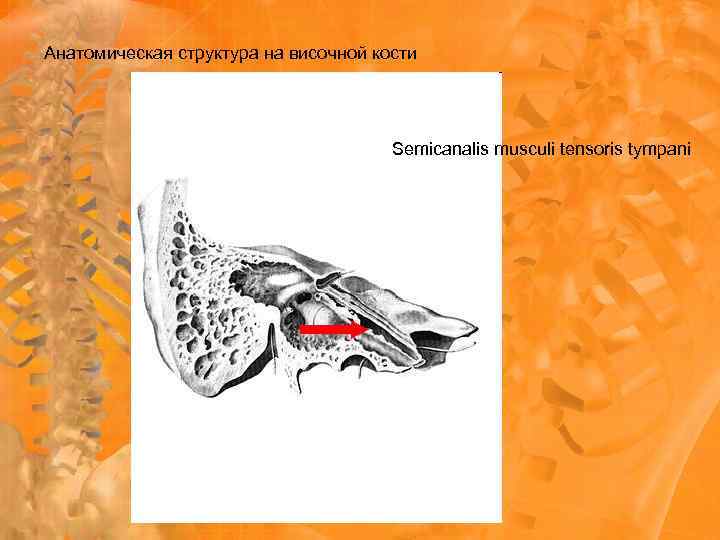 Анатомическая структура на височной кости Semicanalis musculi tensoris tympani 