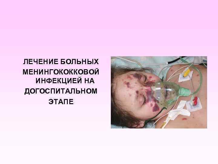 ЛЕЧЕНИЕ БОЛЬНЫХ МЕНИНГОКОККОВОЙ ИНФЕКЦИЕЙ НА ДОГОСПИТАЛЬНОМ ЭТАПЕ 