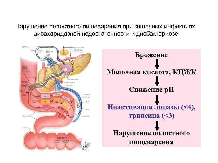 Нарушение полостного пищеварения при кишечных инфекциях, дисахаридазной недостаточности и дисбактериозе Брожение Молочная кислота, КЦЖК