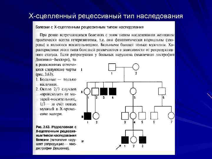 Х-сцепленный рецессивный тип наследования 