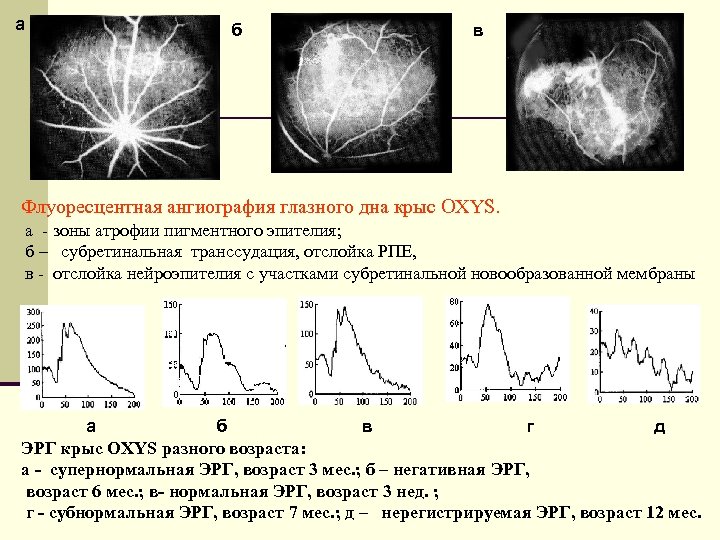 а б в Флуоресцентная ангиография глазного дна крыс OXYS. а - зоны атрофии пигментного