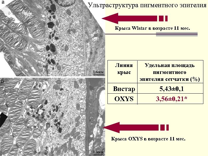 Ультраструктура пигментного эпителия Крыса Wistar в возрасте 11 мес. Линия крыс Вистар OXYS Удельная