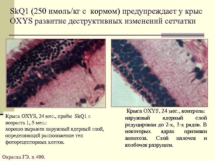 Sk. Q 1 (250 нмоль/кг с кормом) предупреждает у крыс OXYS развитие деструктивных изменений