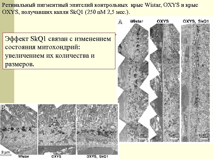Ретинальный пигментный эпителий контрольных крыс Wistar, OXYS и крыс OXYS, получавших капли Sk. Q