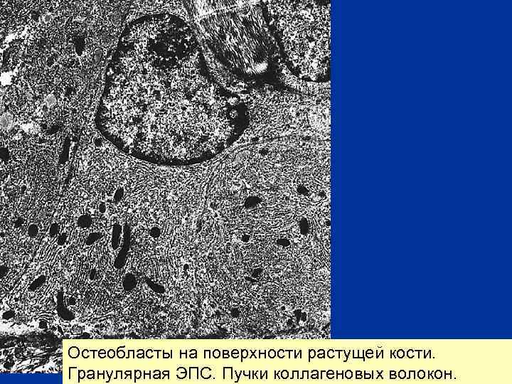Остеобласты на поверхности растущей кости. Гранулярная ЭПС. Пучки коллагеновых волокон. 