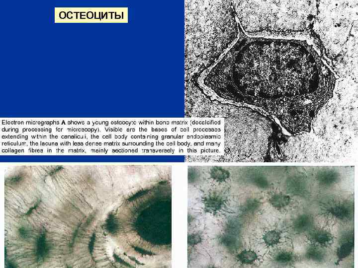 ОСТЕОЦИТЫ 