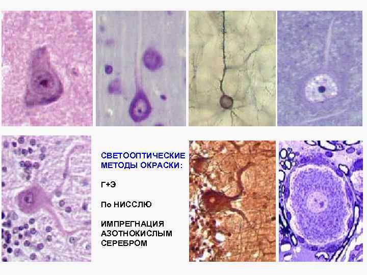 СВЕТООПТИЧЕСКИЕ МЕТОДЫ ОКРАСКИ: Г+Э По НИССЛЮ ИМПРЕГНАЦИЯ АЗОТНОКИСЛЫМ СЕРЕБРОМ 